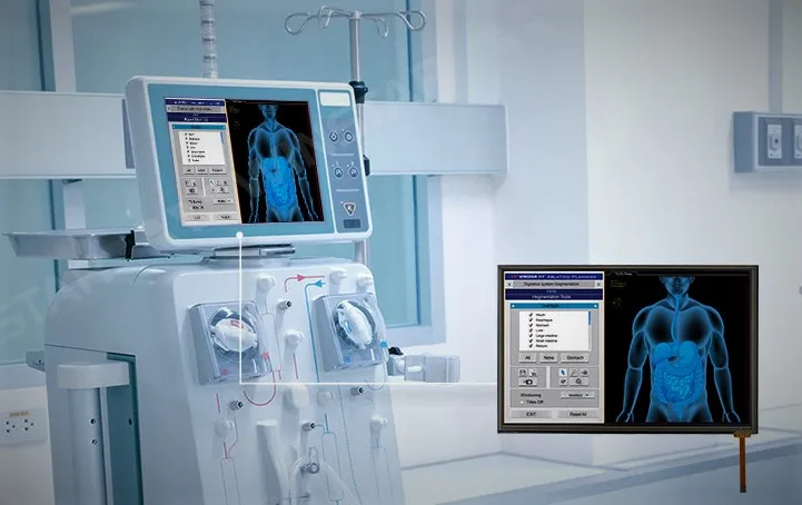Medical Equipment Touchscreen Display